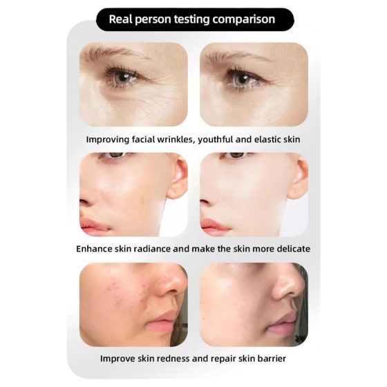Photon Rejuvenation Facial LED Mask